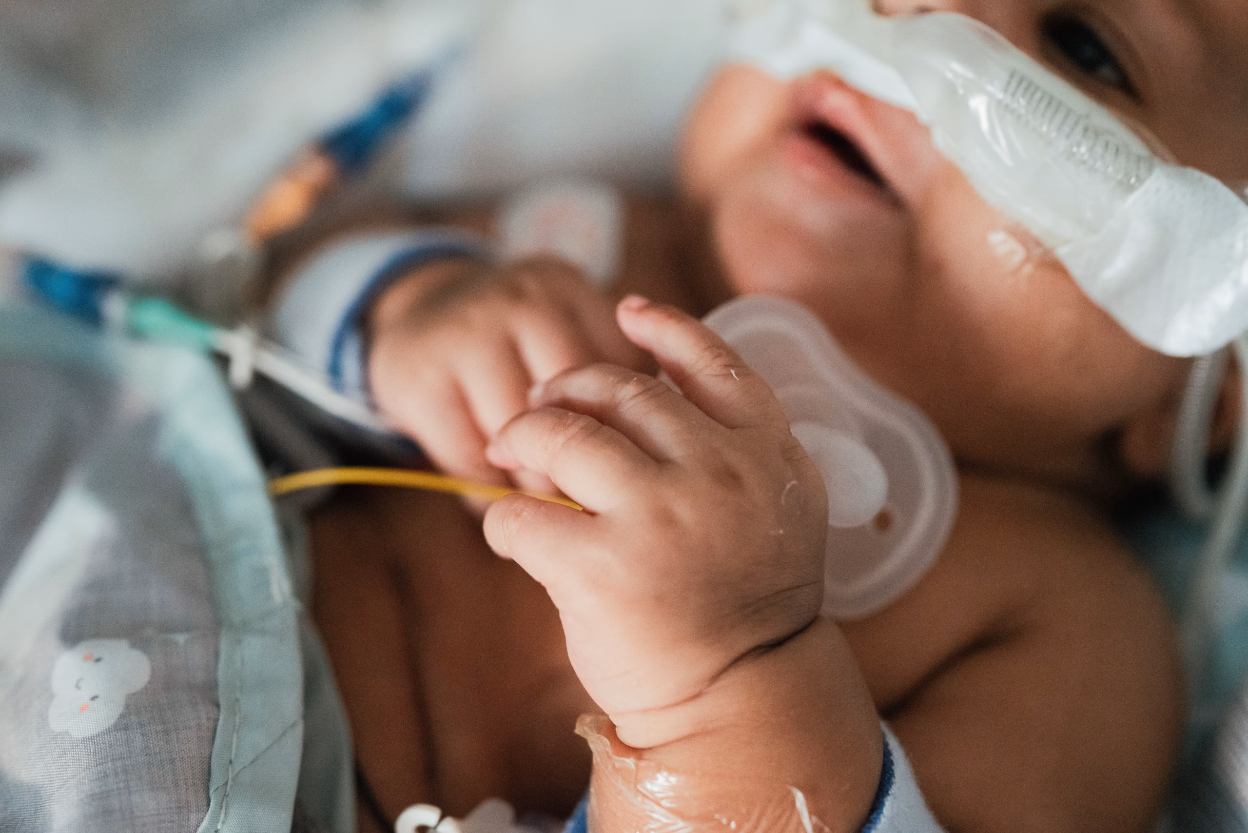 newborn baby with breathing tube in hospital